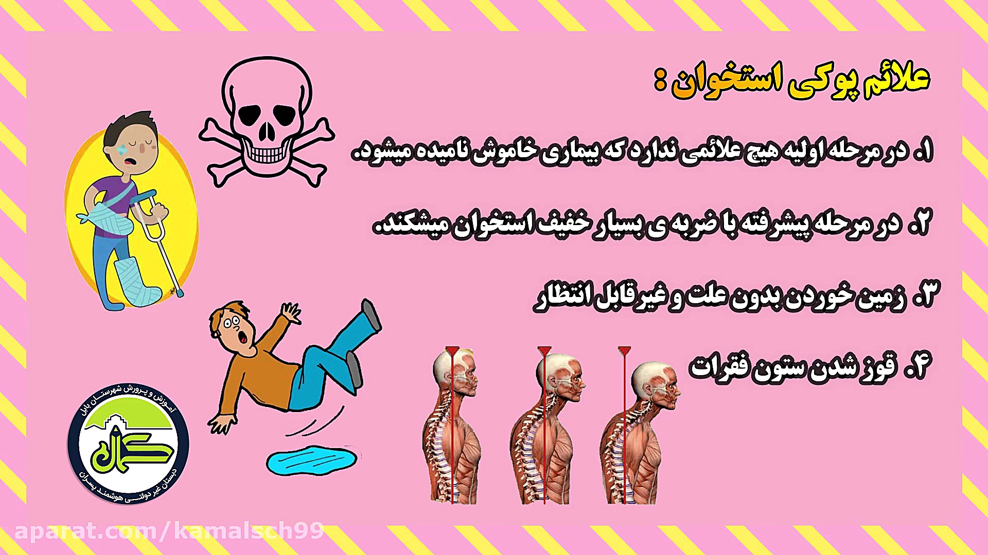 پوکی استخوان لیفت گردنایمپلنت دندان