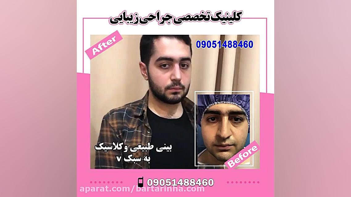 برترین ها - دکتر خسرو مقتدر - متخصص گوش و حلق و بینی لیپوماتیک