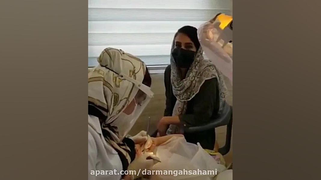 موضوع: عصب کشی دلسا خانم در درمانگاه سهامی TEVAR