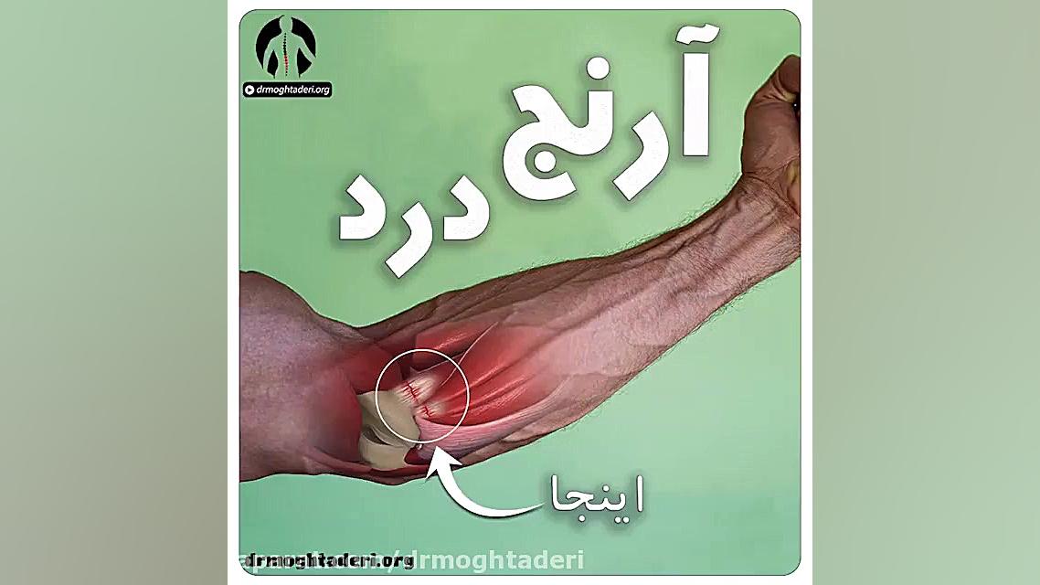 کاهش درد آرنج با ۲ حرکت اصلاحی ساده دکتر علیرضا مقتدری | متخصص طب فیزیکی