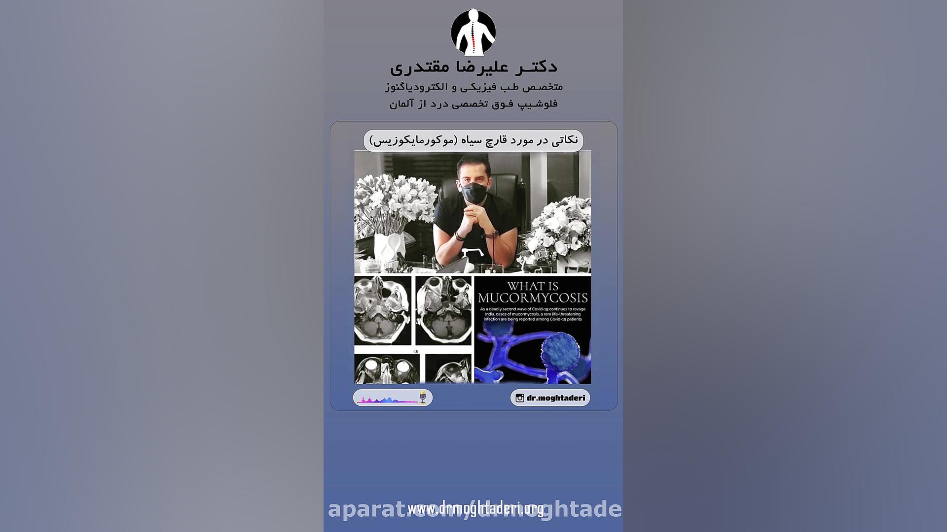 قارچ سیاه و کرونا دکتر علیرضا مقتدری | متخصص طب فیزیکی