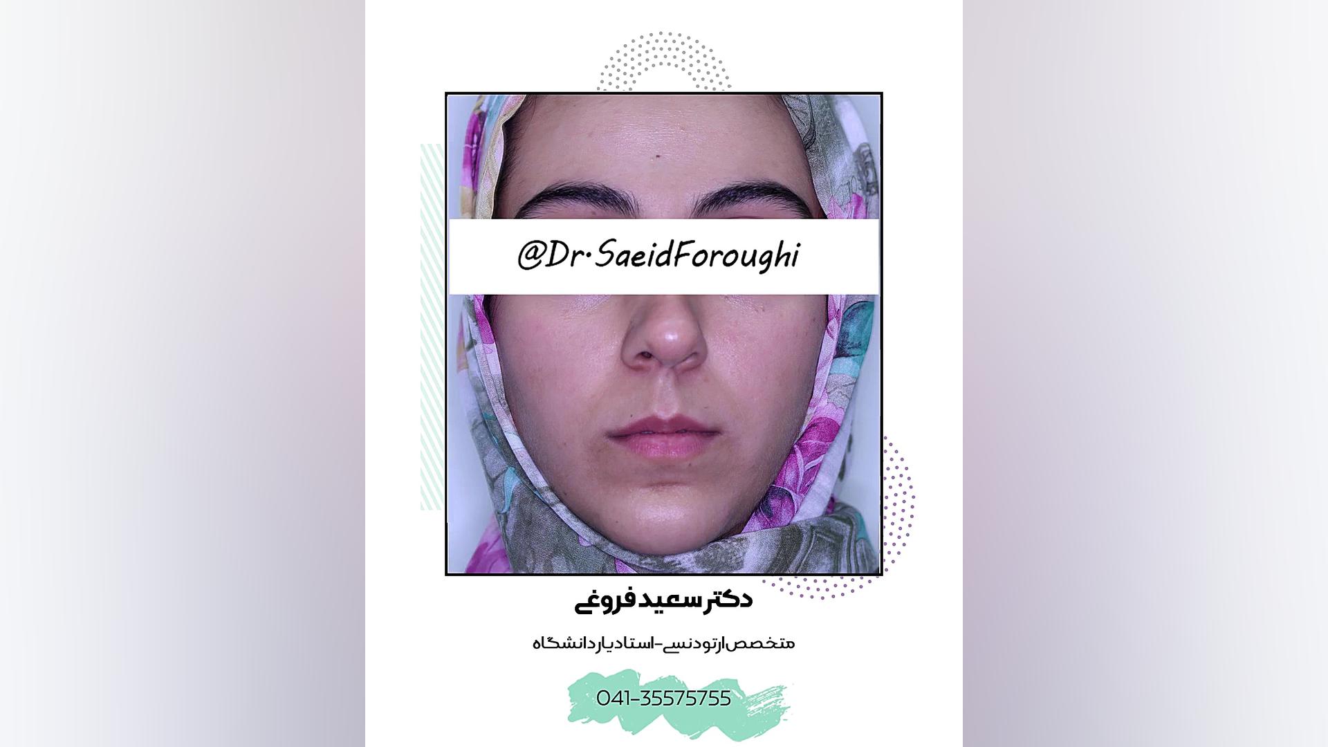 ارتودنسی دندان دکتر سعید فروغی متخصص ارتودنسی