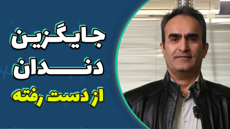 جایگزین دندان از دست رفته چیه؟ - بریج یا ایمپلنت؟ سندرم چیلبلینز