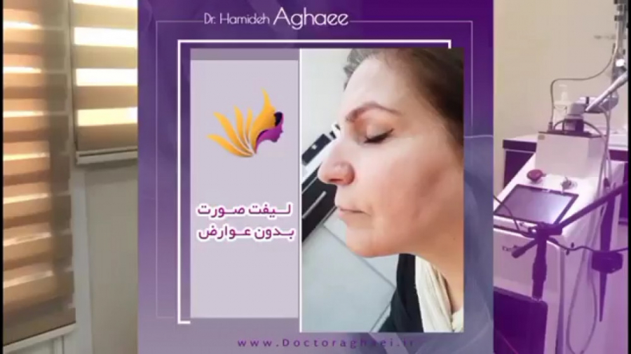 اندولیفت صورت دکتر حمیده آقایی