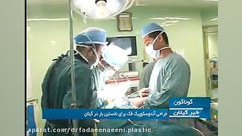 جراحی اندوسکوپیک شکستگی فک تحتانی برای اولین بار گیلان دکتر علیرضا فدایی نایینی