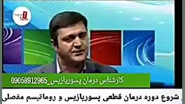 رفع کامل بیماری پسوریازیس یا صدفک بدون کورتون جراحی زیبایی پلک