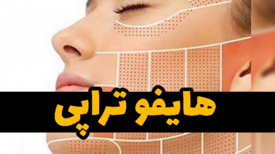 هایفوتراپی چیست؟ دکتر ماندانا رهاب بیماری پورفیری اریتروپوئتیک