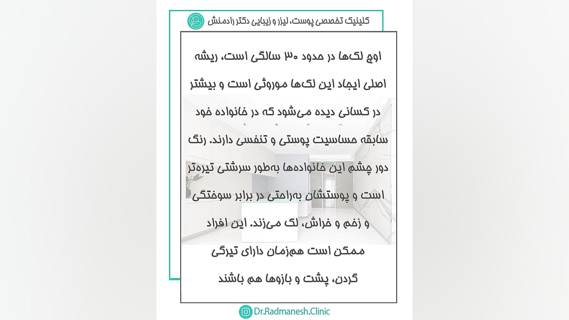 عوامل مستعد کننده ملاسما یا لک صورت دندانپزشک زیبایی