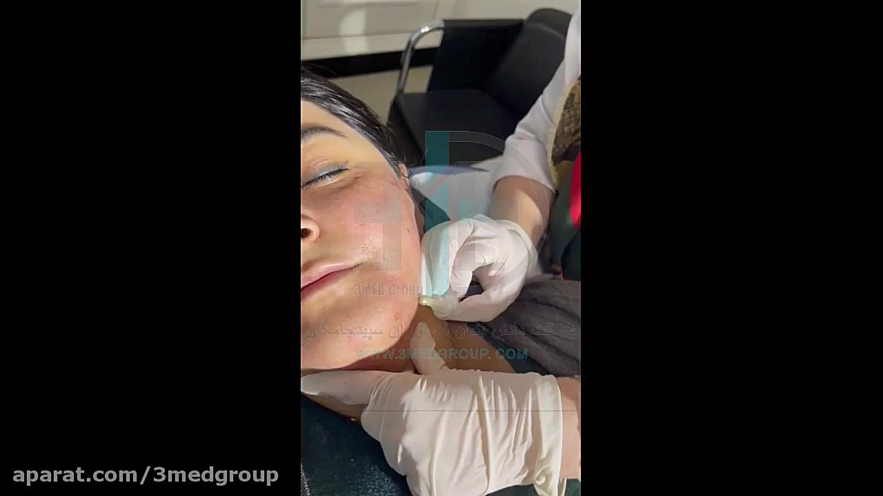 رفع لک های تیره با کربوکسی تراپی MRCP