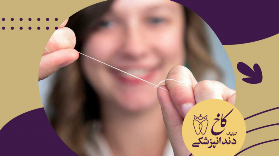 نخ دندان اقتصادی کلینیک دندانپزشکی کاخ