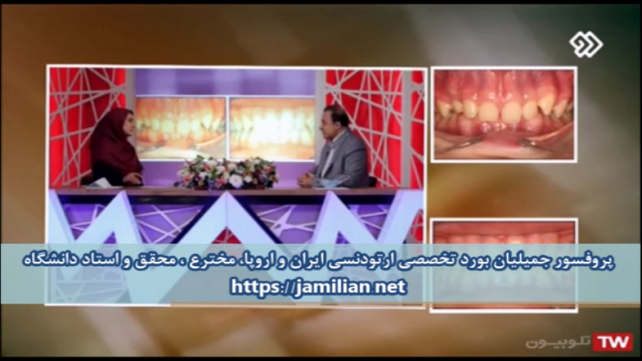 شرایط کشیدن دندان در درمان ارتودنسی / متخصص ارتودنسی / دکتر جمیلیان دکتر عبدالرضا جمیلیان - متخصص ارتودنسی
