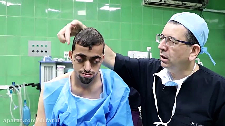 سندروم کروزون دکتر حمید رضا فتحی فوق تخصص جراحی پلاستیک