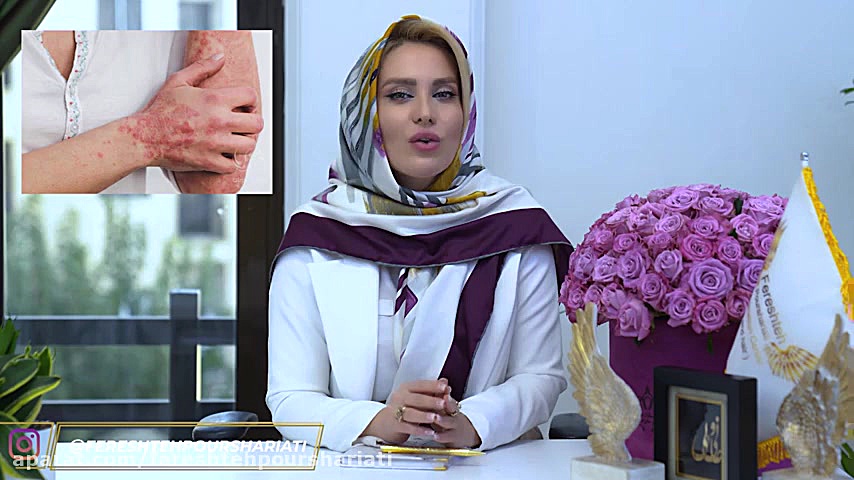 بیماری صدف پوستی ( پسوریازیس ) احمدرضا عابدزاده