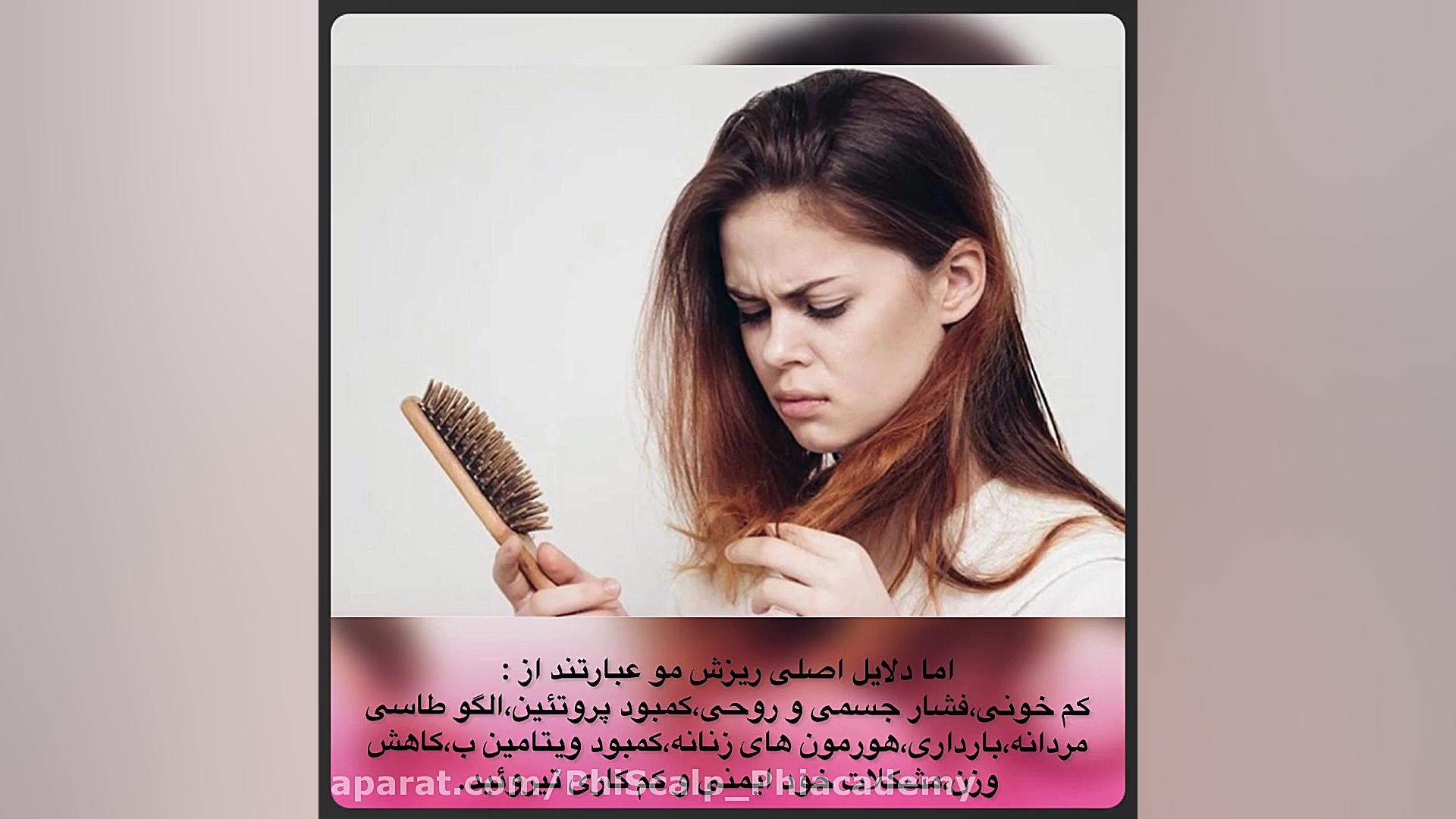 درمان ریزش مو با تکنیک فی اسکالپ تری‌متازیدین