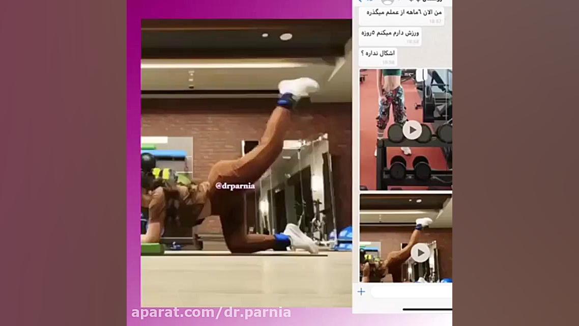 ورزش بعد از عمل جراحي دکتر رفیع پرنیا فوق تخصص پلاستیک