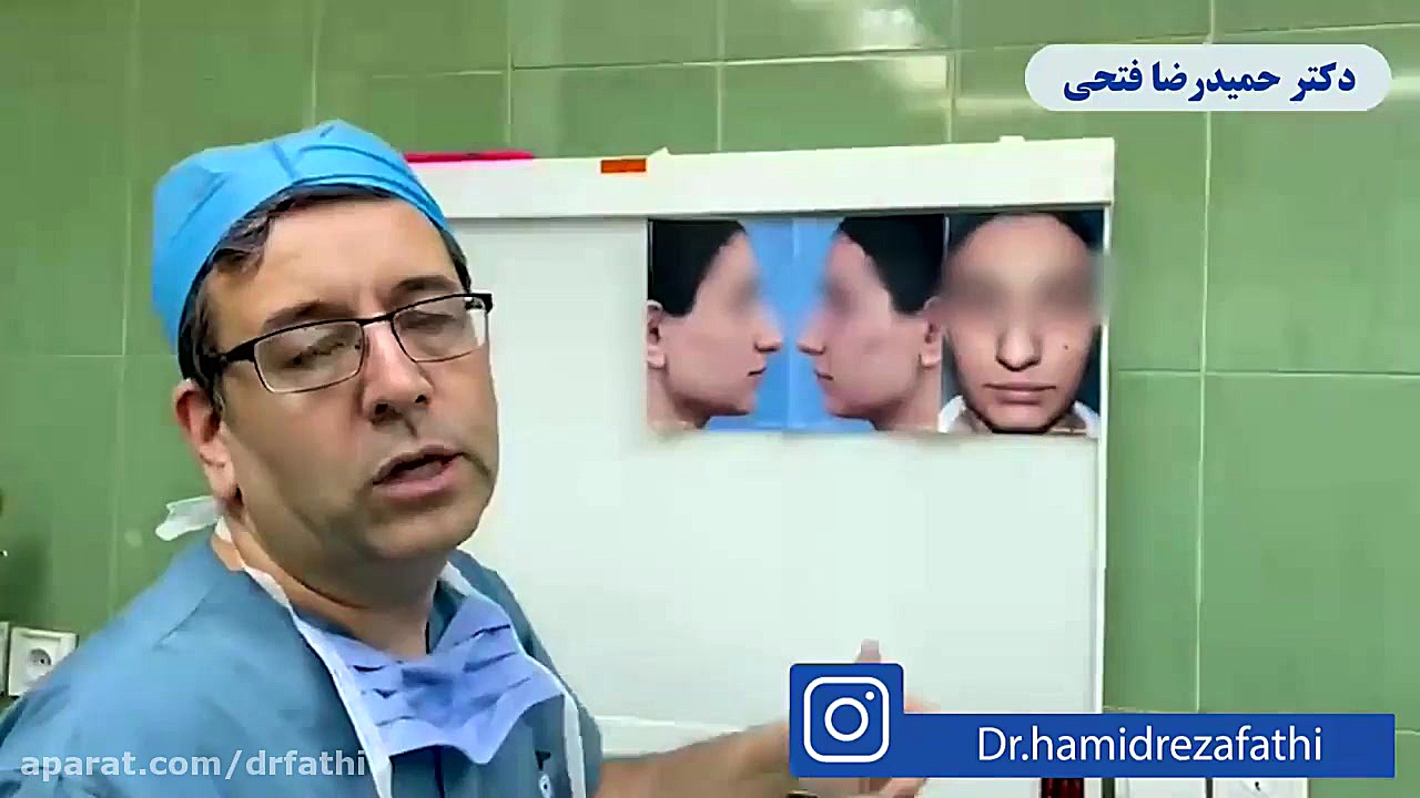 فیلم اتاق عمل جراحی بینی گوشتی دکتر حمید رضا فتحی فوق تخصص جراحی پلاستیک