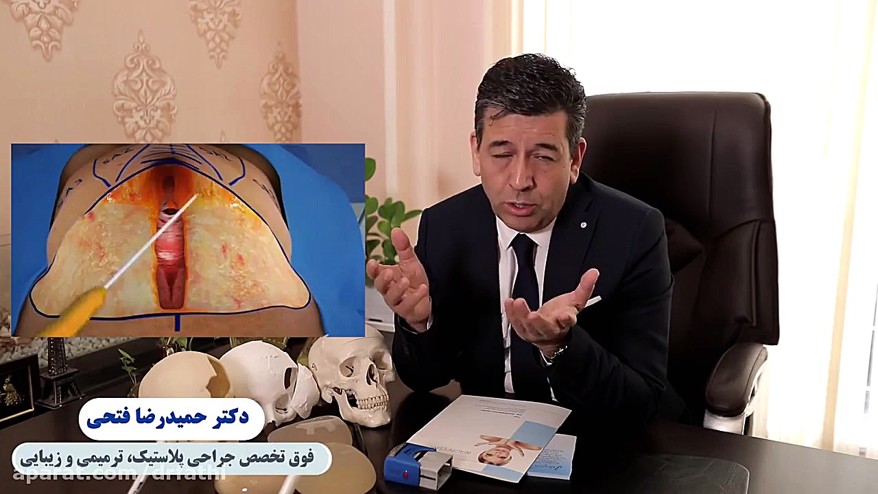 فیلم عمل پیکرتراشی - ساعت شنی دکتر حمید رضا فتحی فوق تخصص جراحی پلاستیک