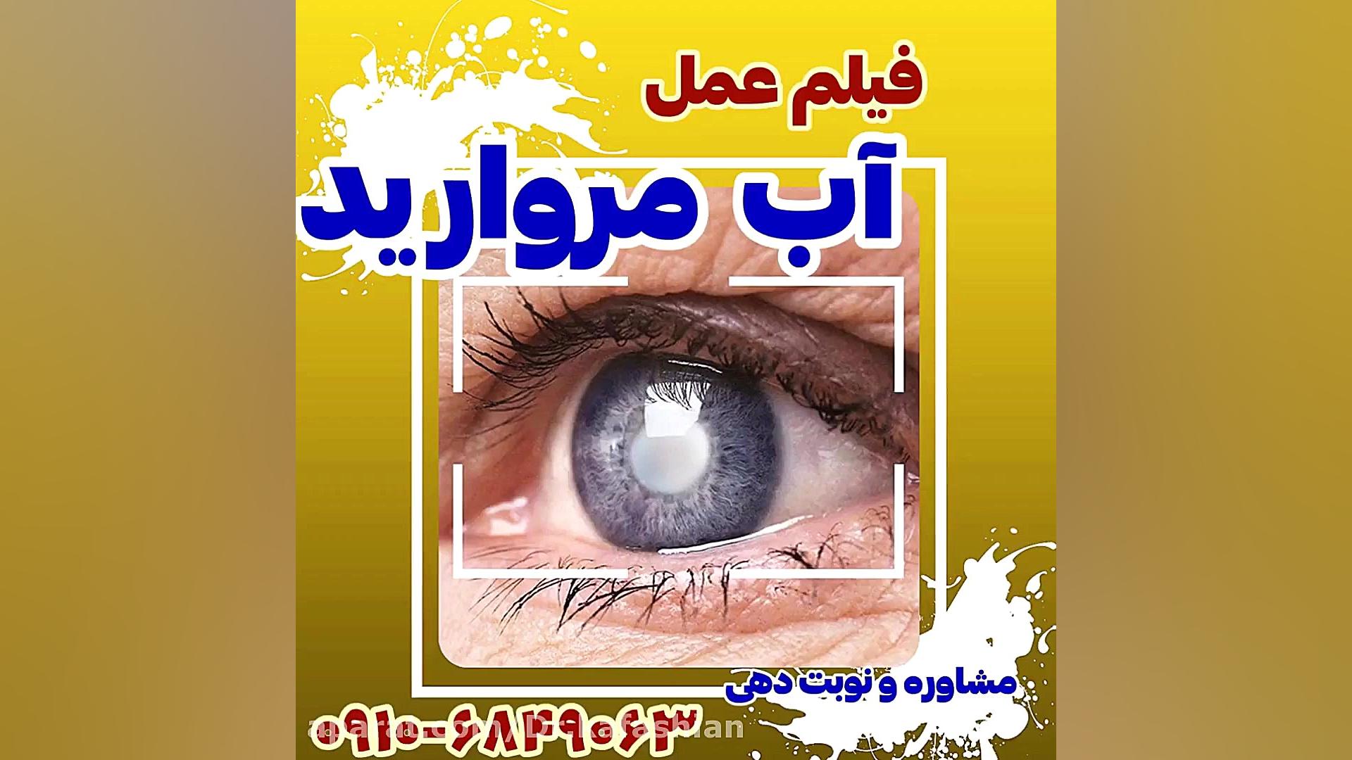 جراحی آب مروارید به روش فیکو یا بدون بخیه ترمیم ونیر