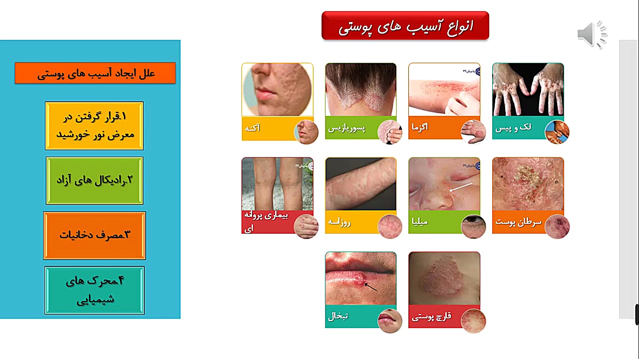 درمان زخم های مزمن با استفاده از سلول های بنیادی چربی لیزر فرکشنال
