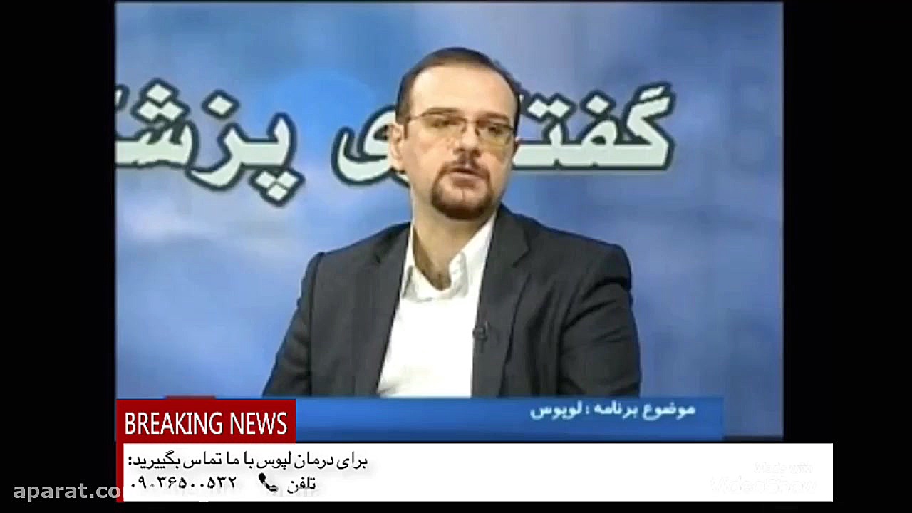 بیماری لوپوس چیست و چگونه درمان میشود زیبایی پوست