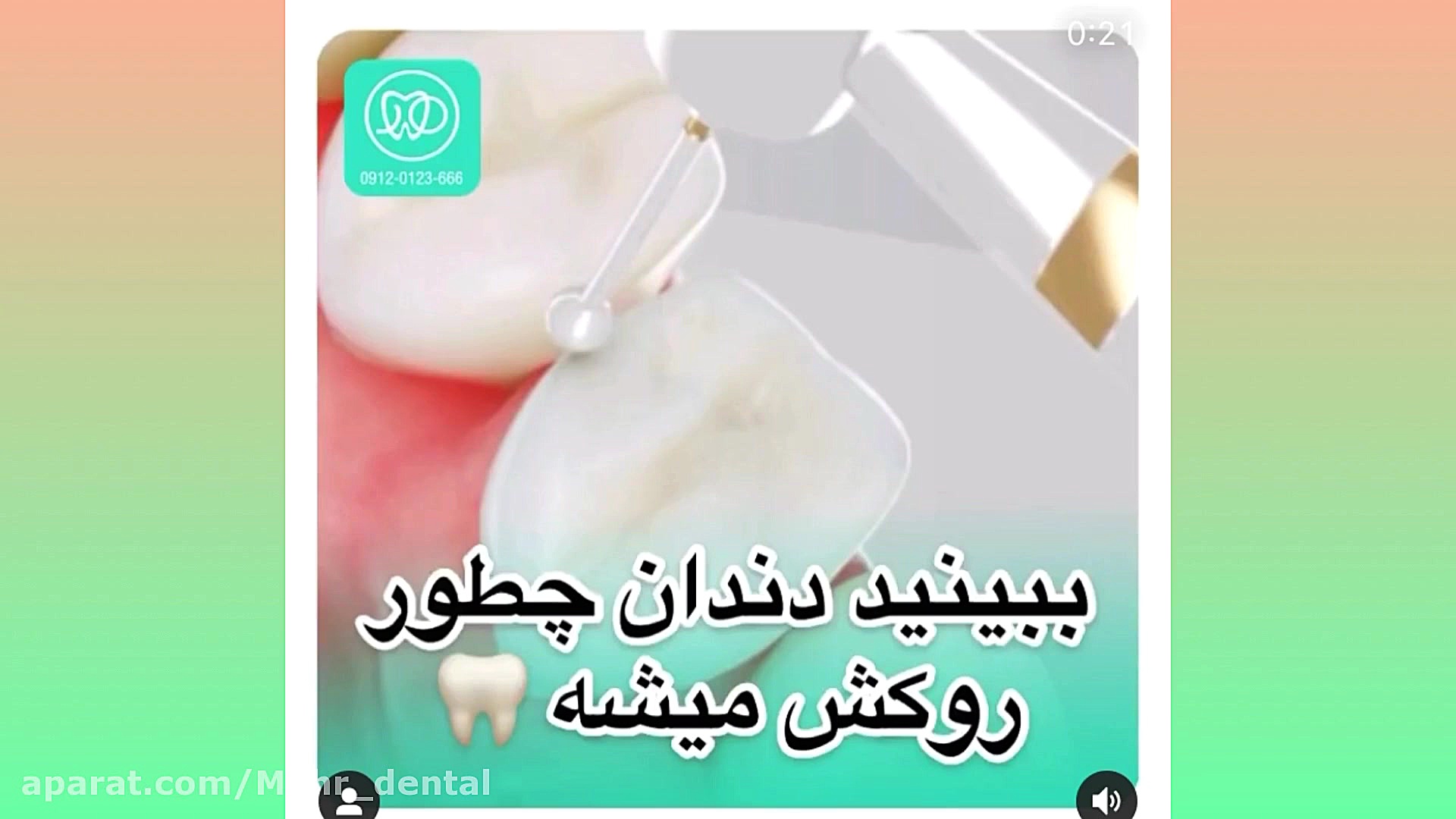 کلینیک دندانپزشکی مهر (mehr_dental_clinic) روکش دندان ها والسارتان