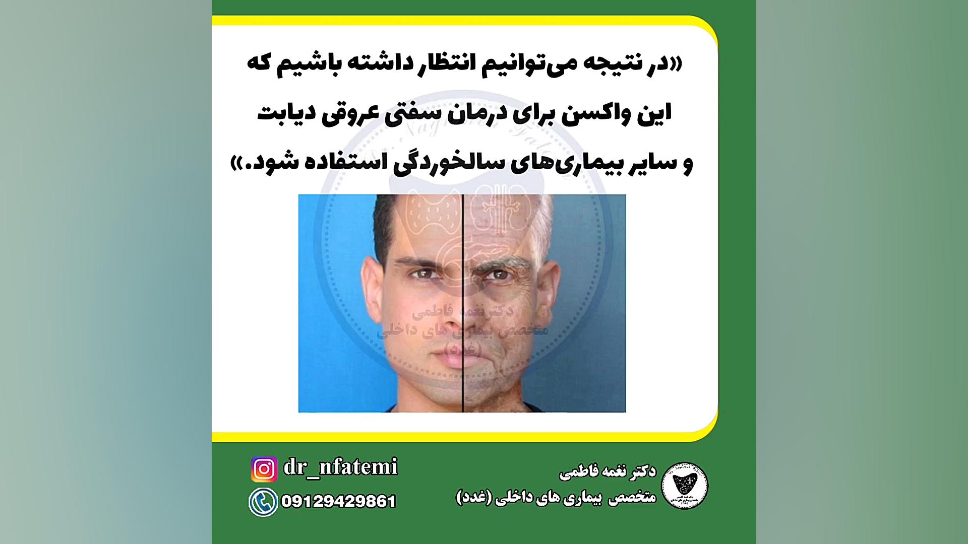 واکسن ضد پیری دکتر نغمه فاطمی