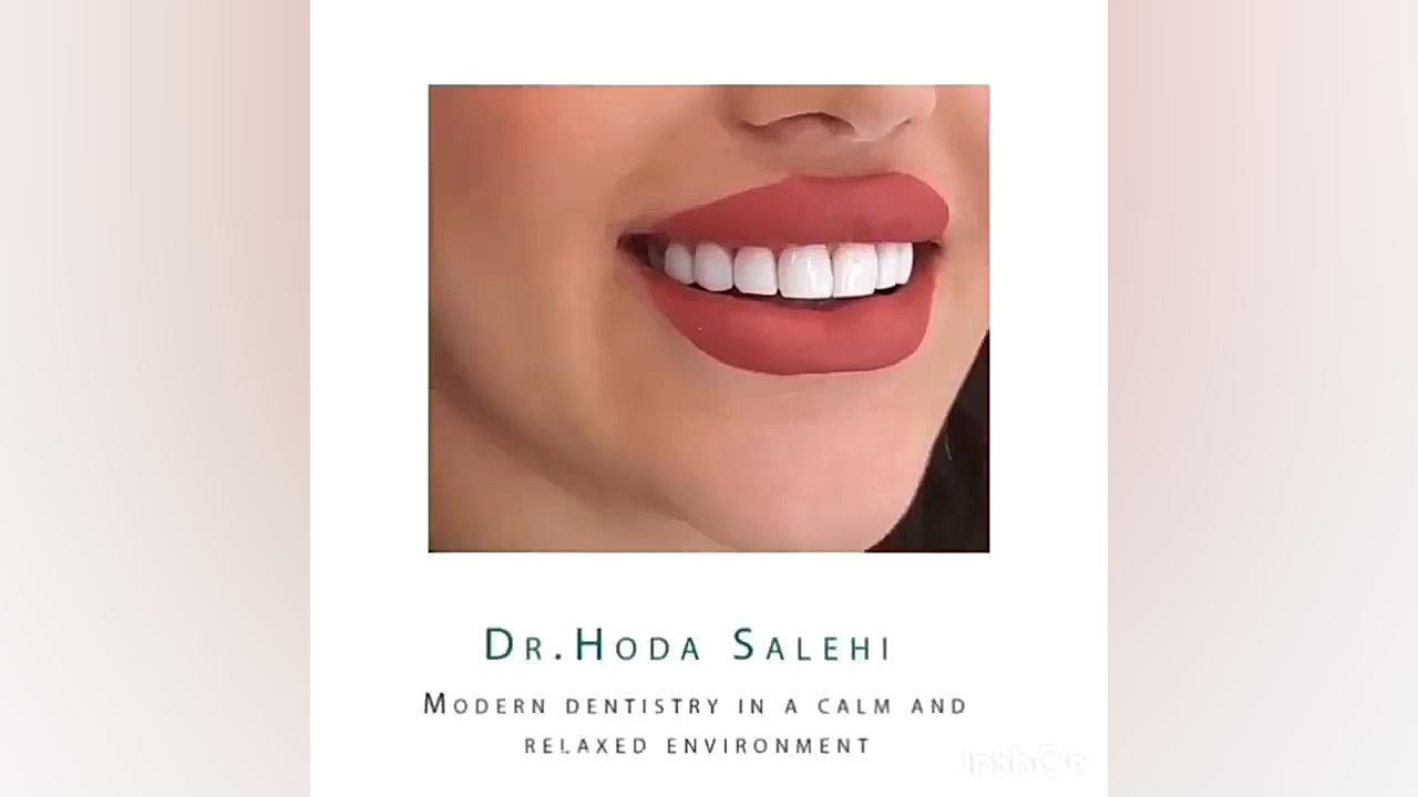دندانپزشک زیبایی در اصفهان | دکتر هدی صالحی دکتر هدی صالحی| دندانپزشک زیبایی در اصفهان