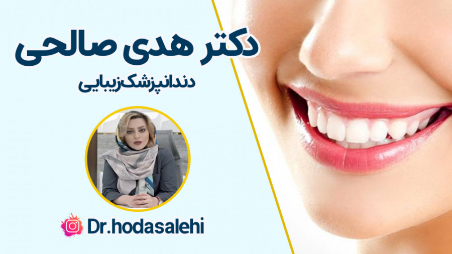 ونیر کامپوزیت دندان های فک بالا و پایین در اصفهان | دکتر هدی صالحی دکتر هدی صالحی| دندانپزشک زیبایی در اصفهان