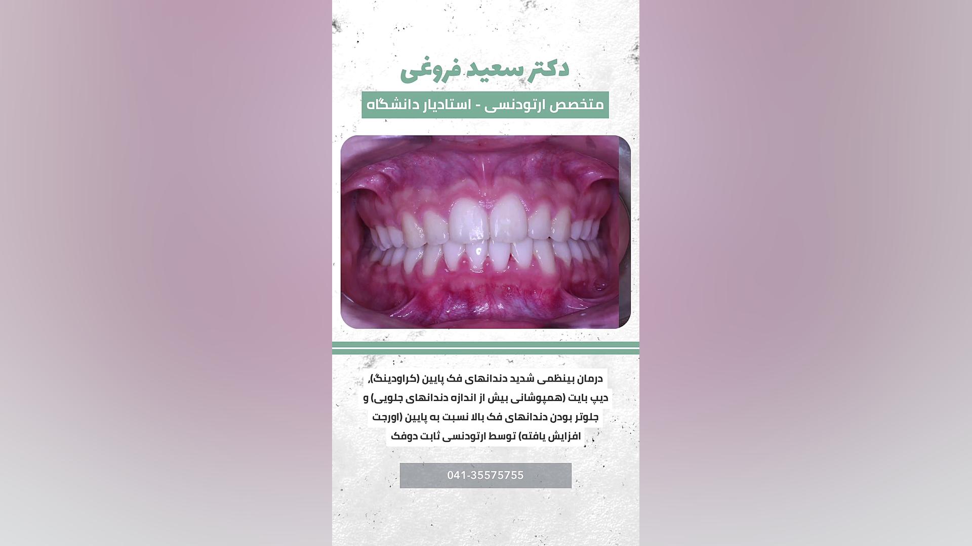 ارتودنسی دندان دکتر سعید فروغی متخصص ارتودنسی