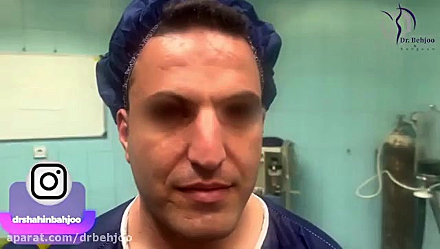 جراحی رینوپلاستی مردانه دکتر شاهین بهجو - فوق تخصص جراحی پلاستیک