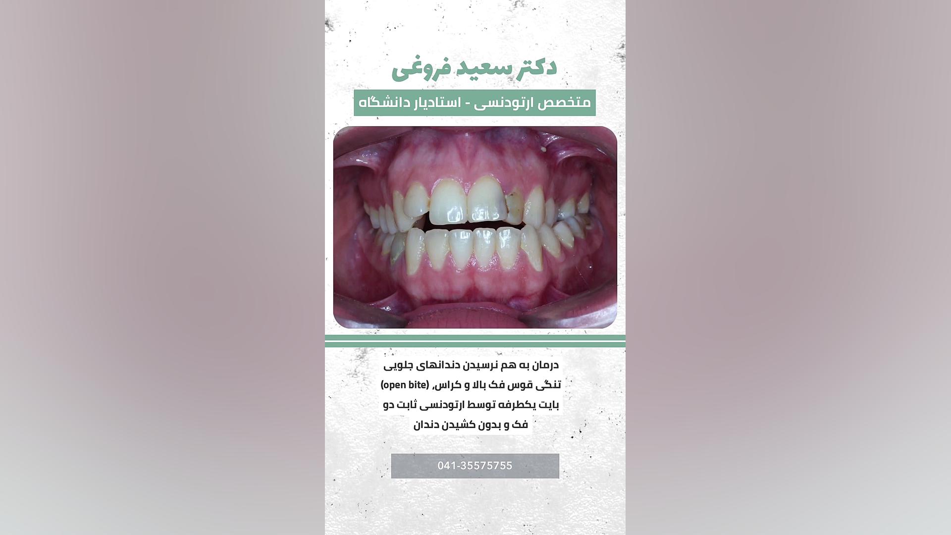 ارتودنسی دندان دکتر سعید فروغی متخصص ارتودنسی