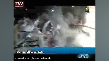 حادثه سقوط بالگرد اورژانس فارس-خبر20:30 - 7فروردین95 جراحی لثه