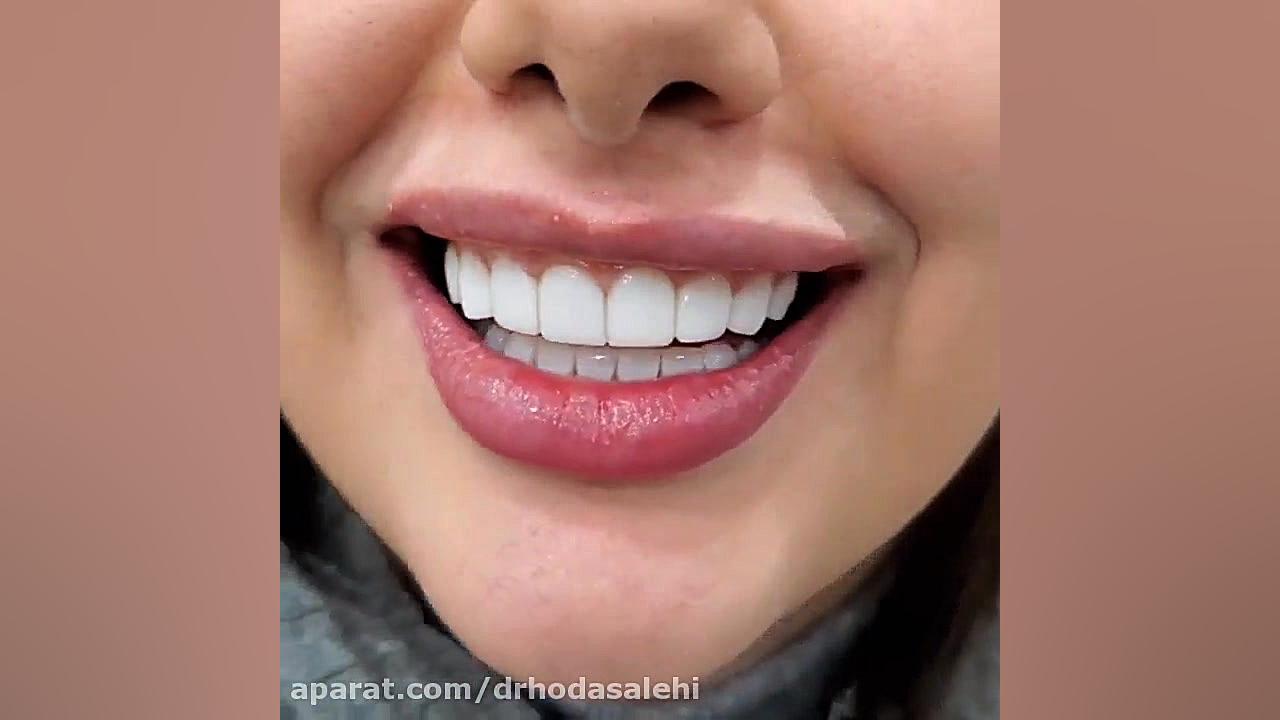 دکتر هدی صالحی دندانپزشک زیبایی در اصفهان دکتر هدی صالحی| دندانپزشک زیبایی در اصفهان