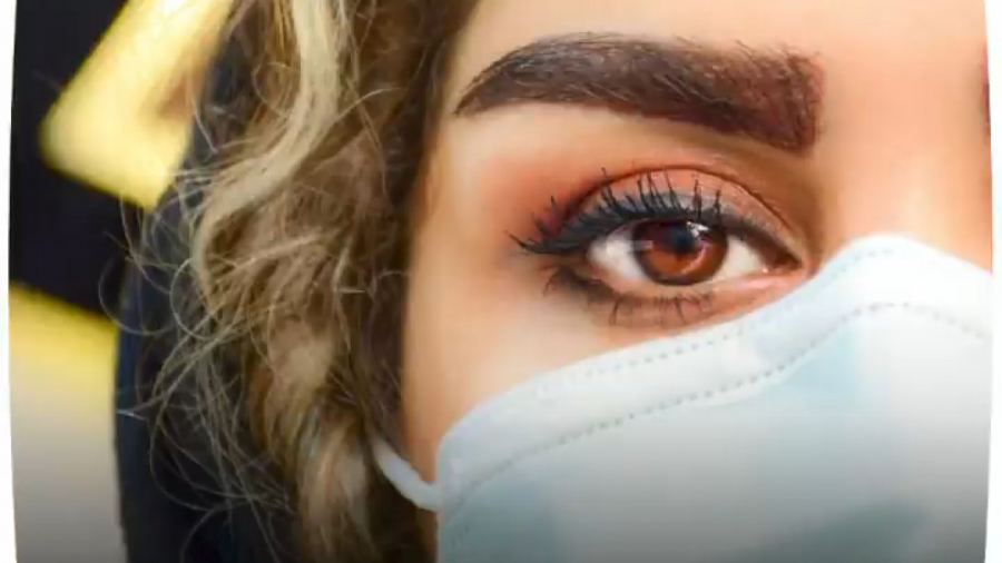 فیلم یک ماه بعد از کاشت ابرو در بهترین کلینیک کاشت مو پلاستیک لثه