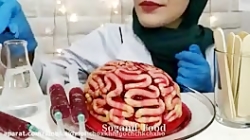 چالش غذا