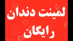 لمینت متحرک دندان اسنپ آن اسمایل