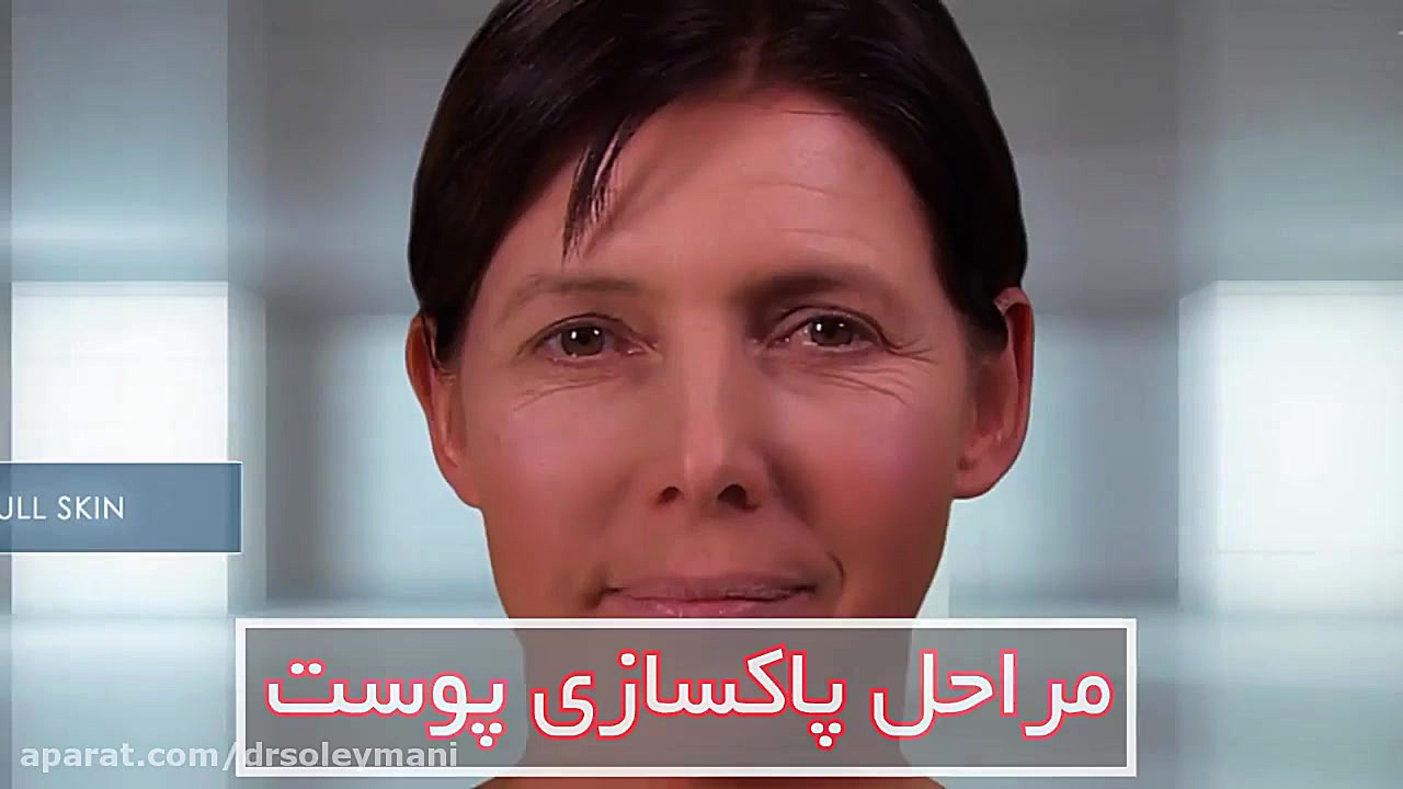 ️مراحل پاکسازی پوست دکتر امیر سلیمانی