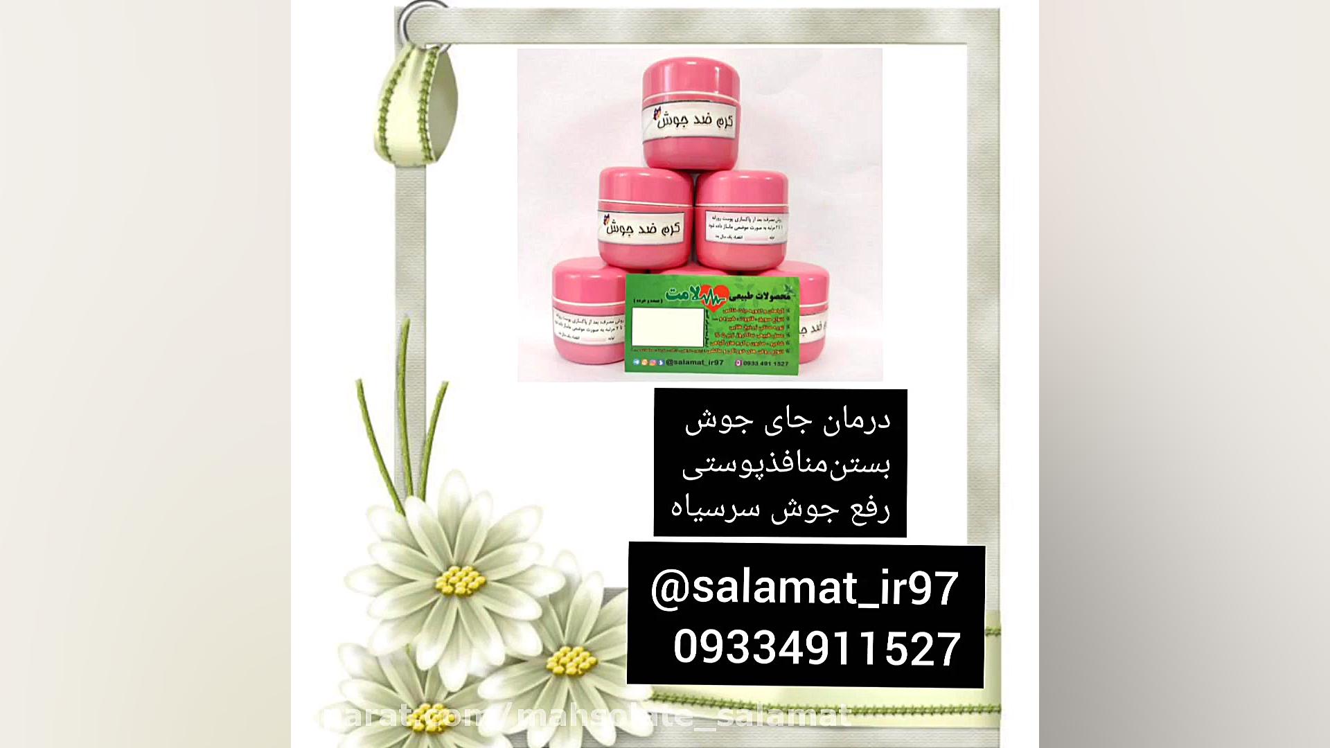 کرم ضدجوش سلامت09334911527 عصب‌کشی