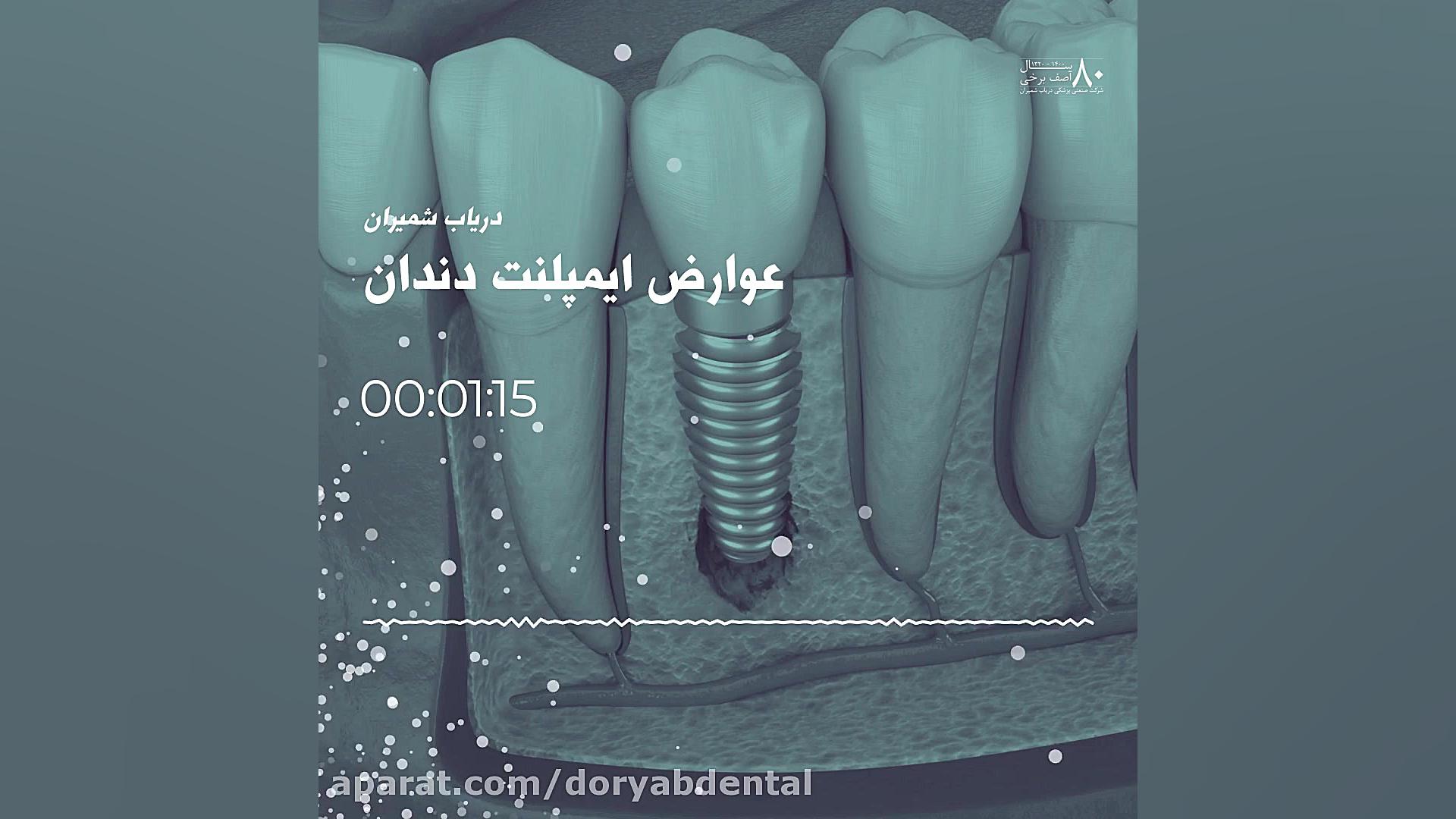 عوارض ایمپلنت دندان قارچ‌شناسی پزشکی