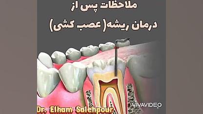 ترمیم شکستگی دندان با کامپوزیت بهترین دندانپزشک زیبایی و ترمیمی ربات میکرونانو جراحی