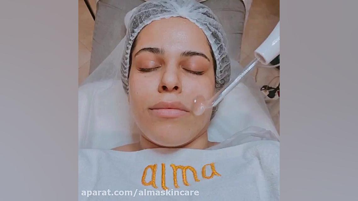 پاکسازی پوست در کلینیک زیبایی آلما در رشت تزریق بوتاکس