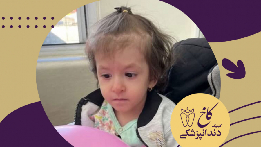 دندانپزشکی با بیهوشی اطفال کلینیک دندانپزشکی کاخ