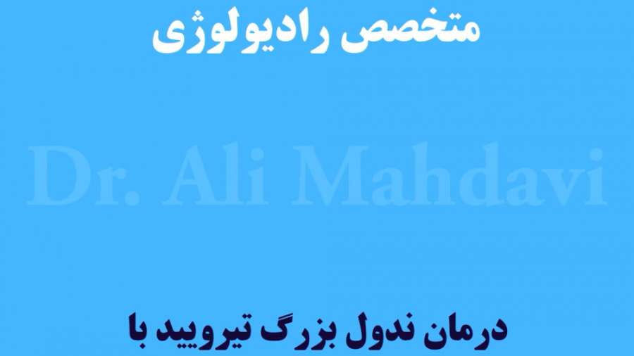 درمان ندول تیریید با استفاده از RF Ablation توسط دکتر علی مهدوی زمان93ثانیه