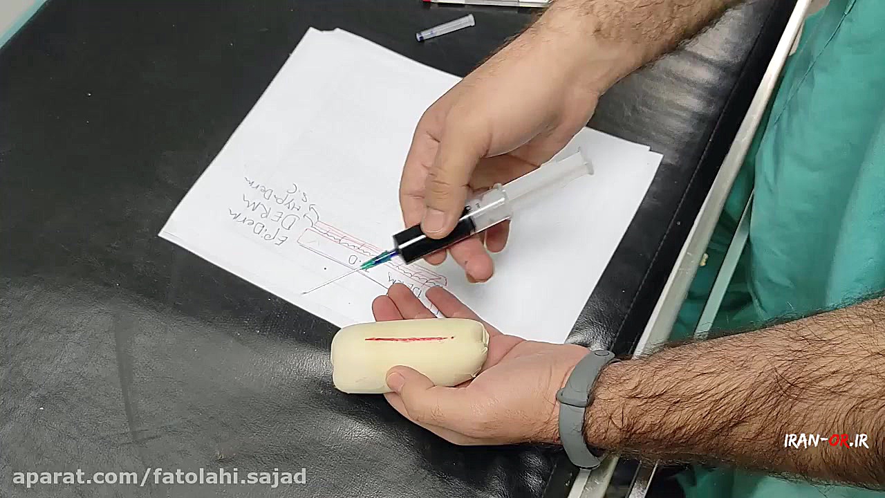 آموزش بی حس کردن زخم با لیدوکائین رادیو اینترنتی