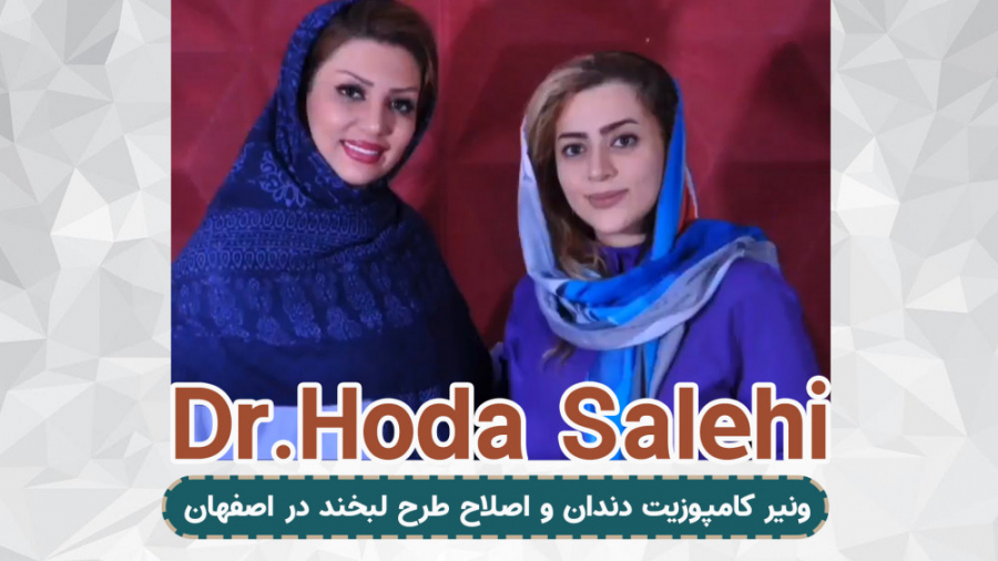 ونیر کامپوزیت در اصفهان | دکتر هدی صالحی دکتر هدی صالحی| دندانپزشک زیبایی در اصفهان