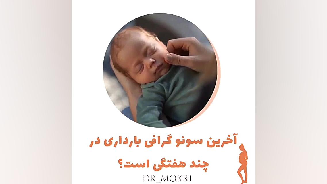 سونوگرافی سه ماهه بارداری شلپ شلپ