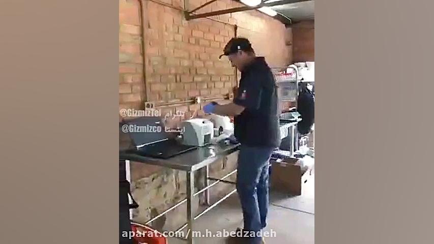 عصب کشی دندون شیر بیماری منیر