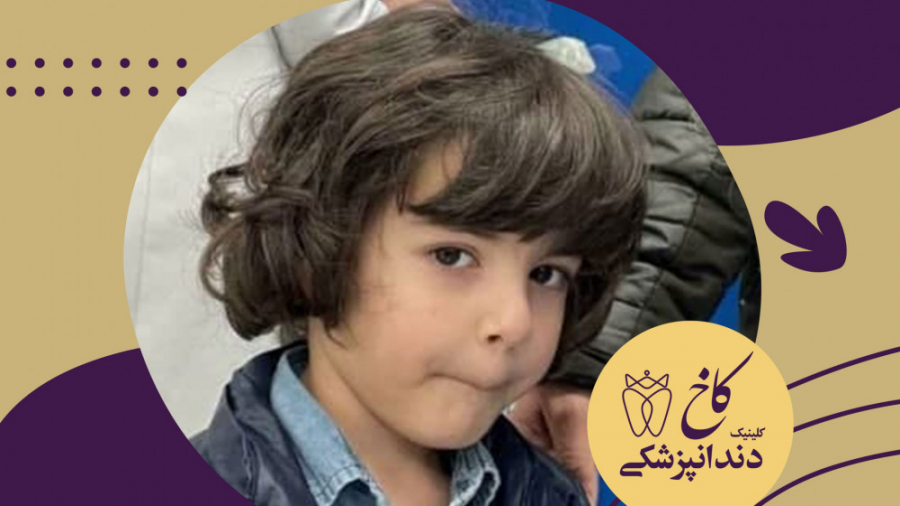 دندانپزشکی با بیهوشی برای حسین جون کلینیک دندانپزشکی کاخ