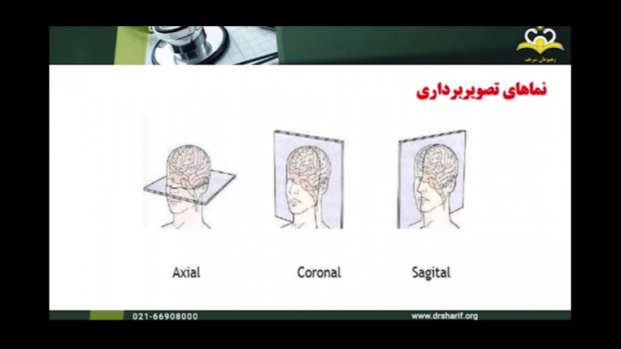 رهبورد مهارتی : Brain MRI روانپزشکی -دکتر اعظم علی اکبریان لمینت