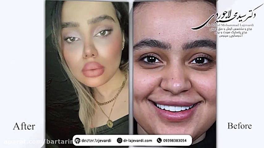 برترین ها - دکتر سید محمد لاجوردی - بورد تخصصی گوش حلق بینی و جراح سر و گردن رفع غبغب